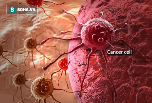 Phát hiện phương pháp vô hiệu hóa sự lan rộng tế bào ung thư - Ảnh 1.